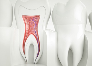 Animation of inside of tooth